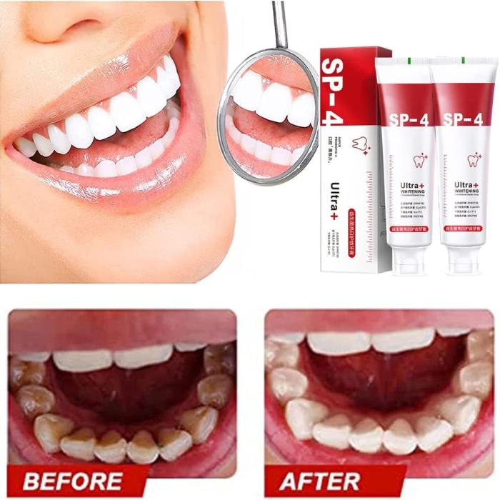 SP4 Probiotic Teeth Whitening & Fresh Breath Toothpaste