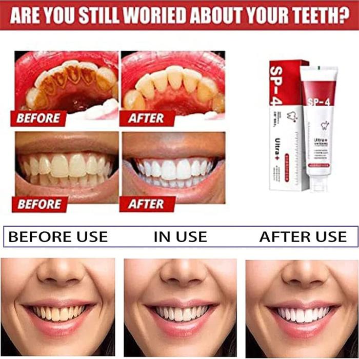 SP4 Probiotic Teeth Whitening & Fresh Breath Toothpaste